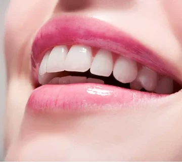 همه چیز درباره ترمیم زیبایی دندان جلو