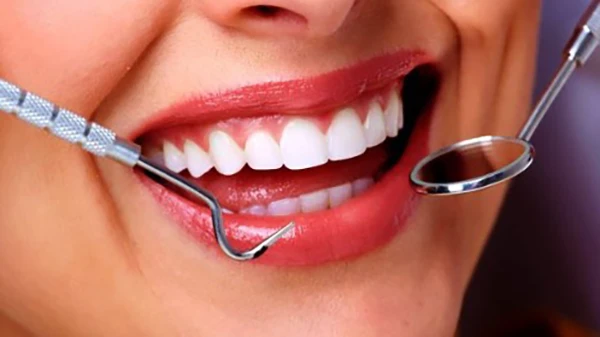 لمینت ips دندان :مزایا، کاربرد و مراقبت های بعد از آن