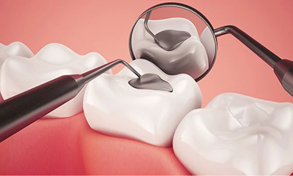 روش های مختلف ترمیم دندان